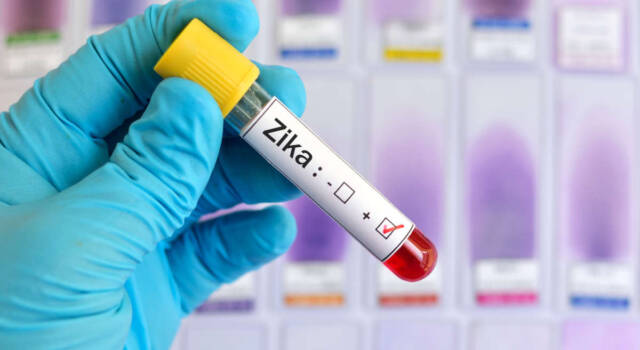 Tutte le precauzioni e i consigli di viaggio per evitare il contagio del Virus Zika