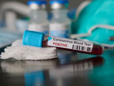 Coronavirus in Italia, il bollettino delle ultime 24 ore
