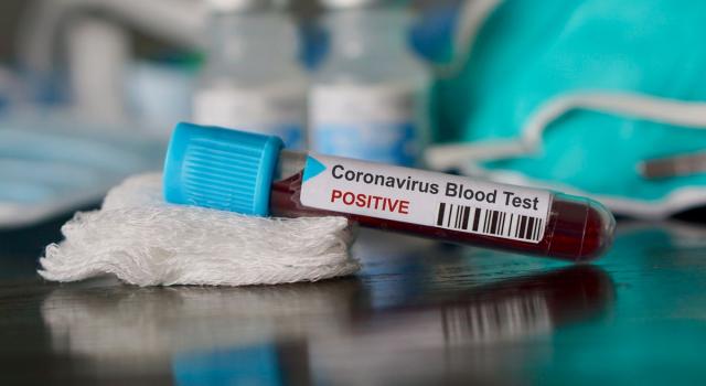 Coronavirus, trend in calo. Iss: &#8220;Iniziata la discesa&#8221;