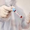 Covid, lo spray nasale per prevenire il contagio