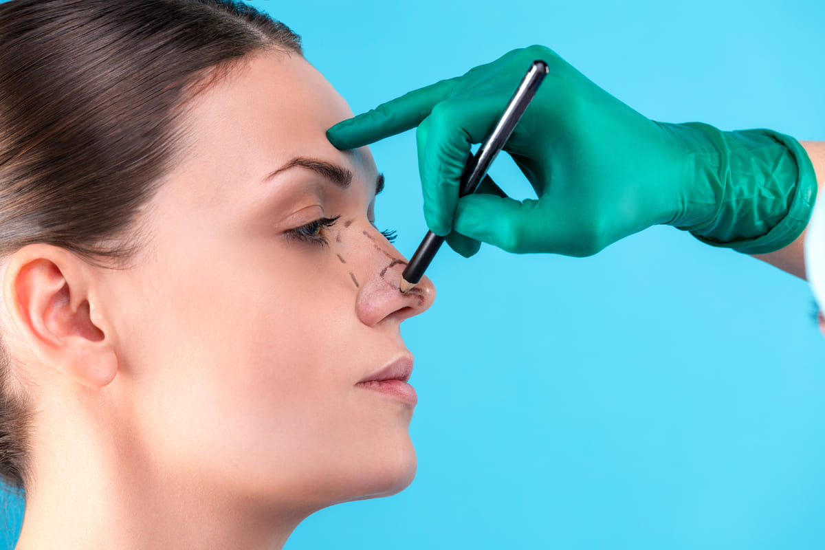 chirurgo estetico naso rinoplastica