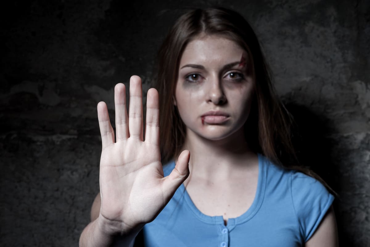violenza donne stop lividi