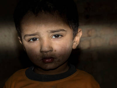 bambino vittima della guerra