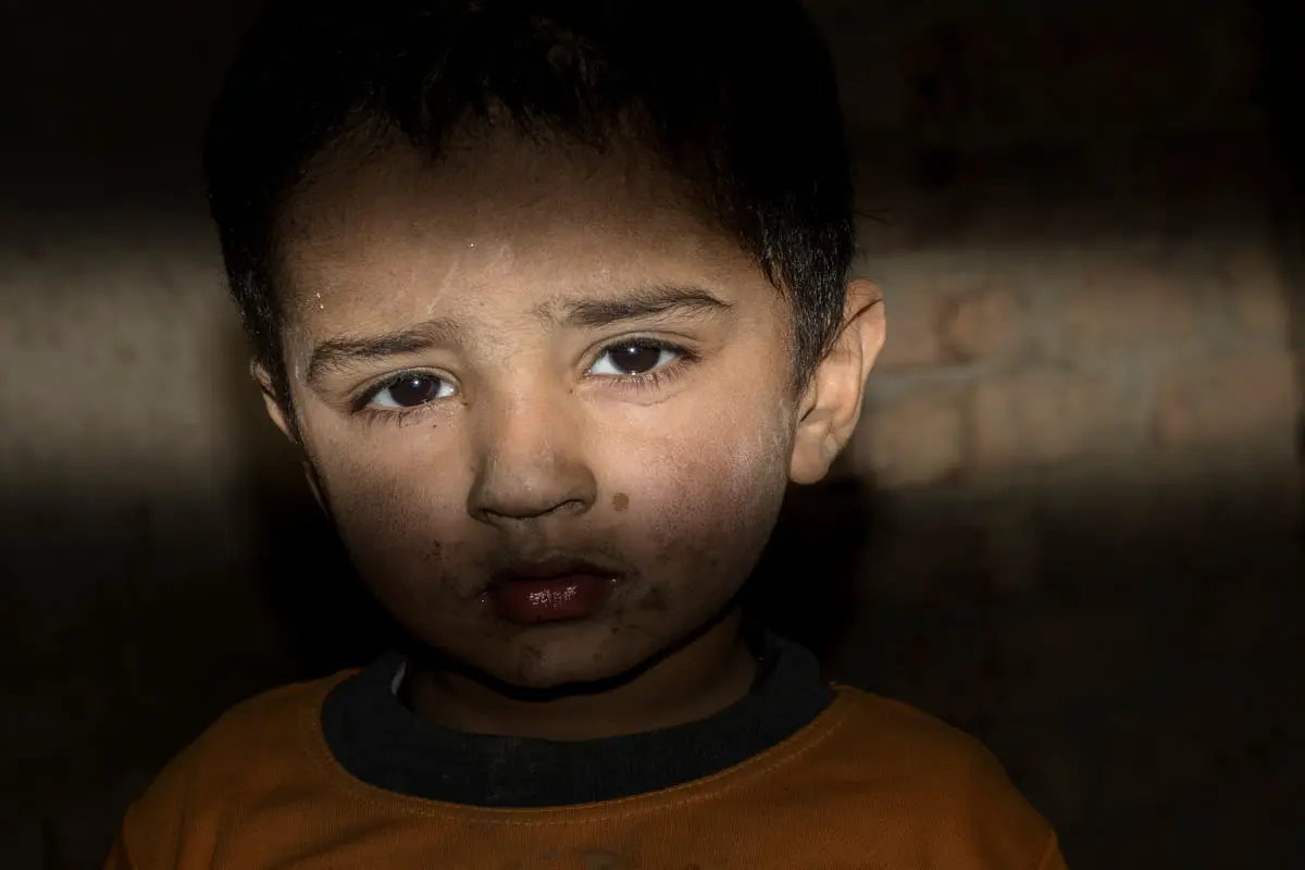 bambino vittima della guerra