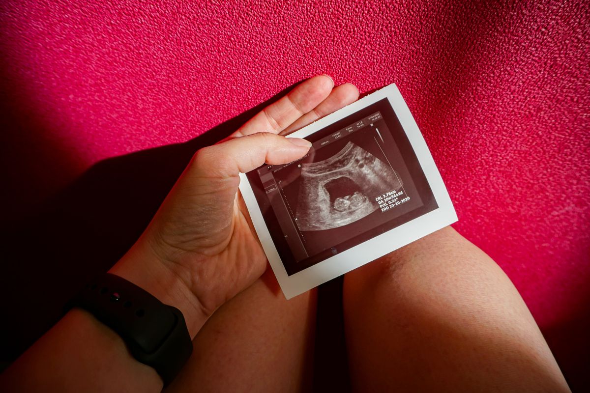 Petizione shock, per chi vuole abortire: “Ascoltare battito del feto”