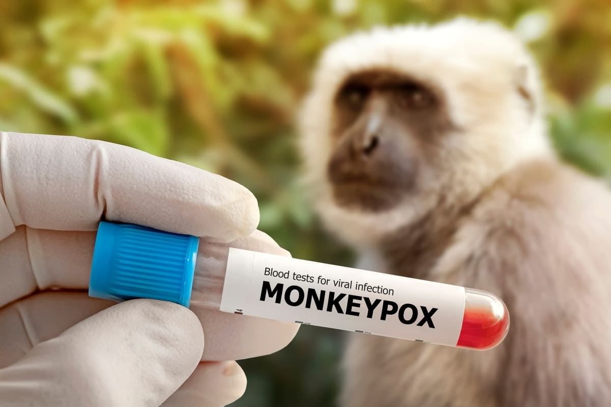 provetta per test sul vaiolo delle scimmie