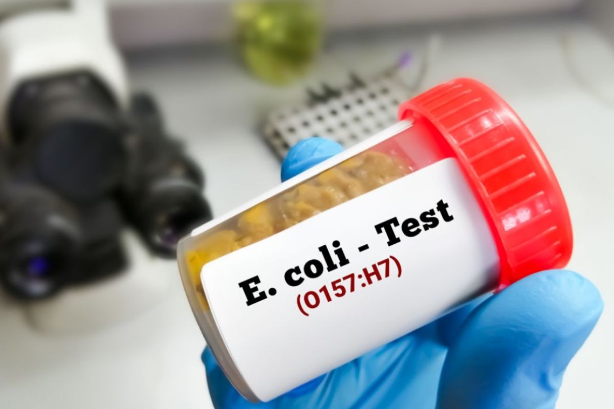 Allarme Escherichia coli: “Livello preoccupante”. Ecco dove