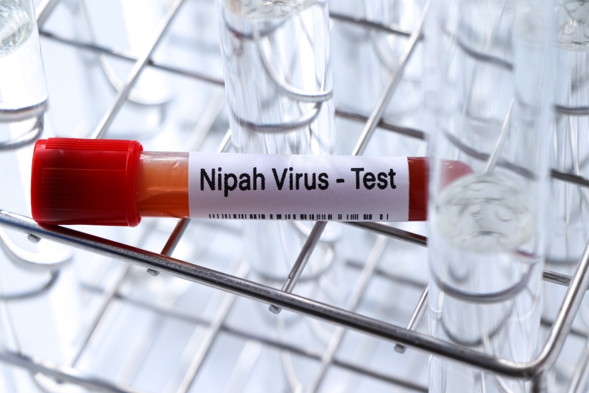 provetta di sangue per test virus Nipah