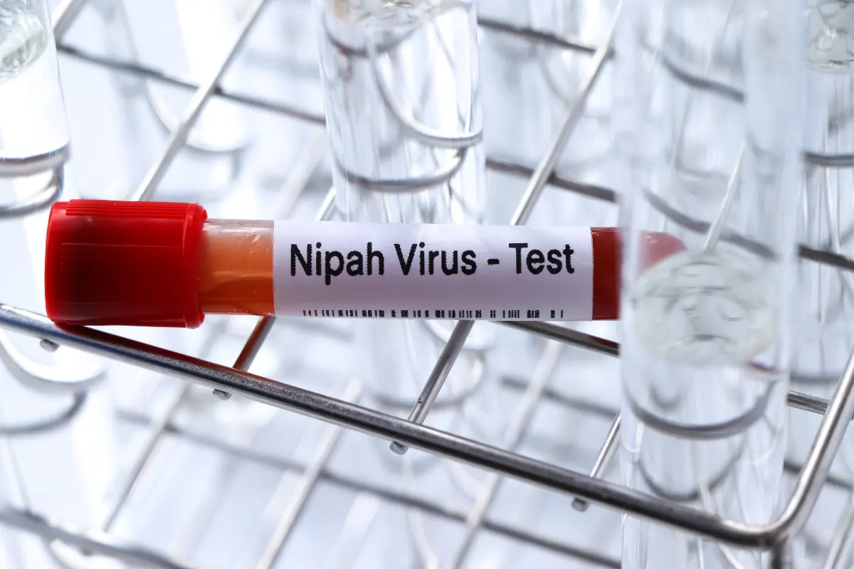 provetta di sangue per test virus Nipah
