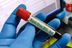 provetta di sangue per test virus Nipah