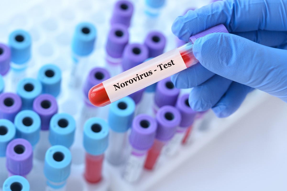 test in provetta di Norovirus