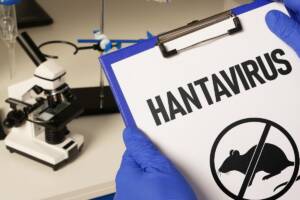 cartella per controlli per Hantavirus