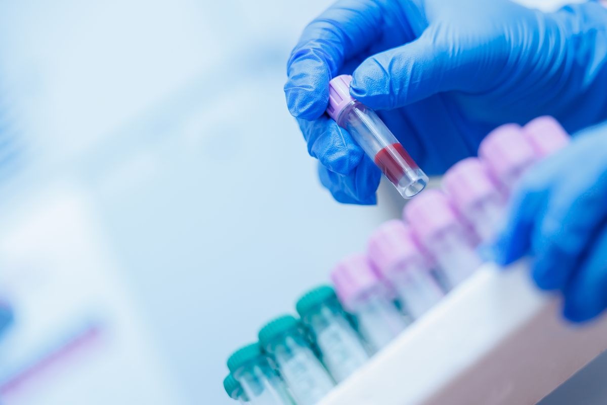 alcuni campioni in provetta di laboratorio