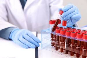 un medico con delle provette di sangue in laboratorio